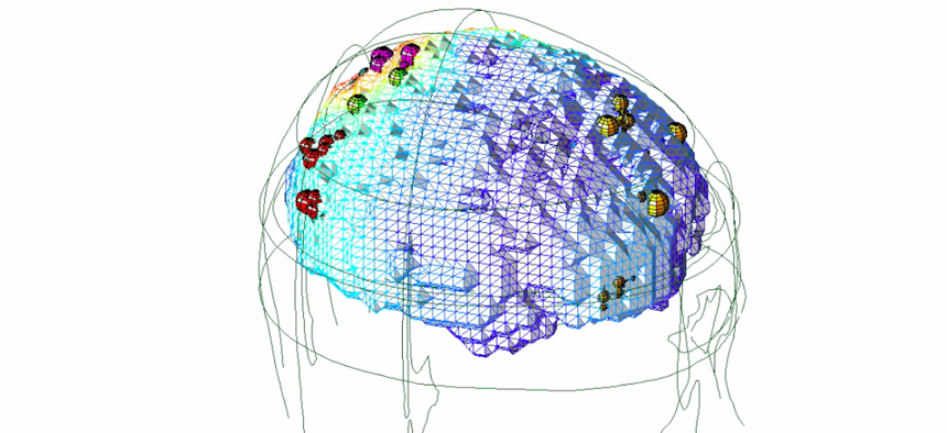 A data visualization showing different regions of brain in terms of electrical activity, gathered via EEG.