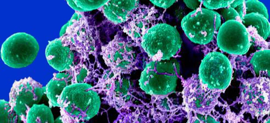 his 2011 digitally-colorized electron microscope image made available by the National Institute of Allergy and Infectious Diseases shows a clump of green-colored, spheroid-shaped, Staphylococcus epidermidis bacteria on a purple-colored matrix. 