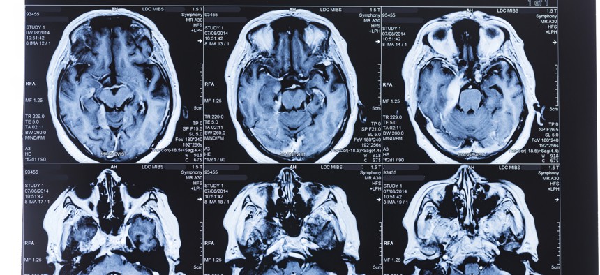 MRI scans of the human brain