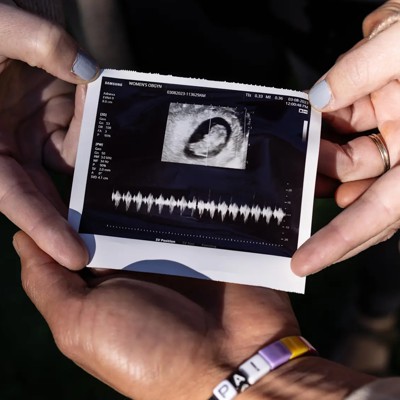 A Coast Guard commander miscarried. She nearly died after being denied care. A Coast Guard commander miscarried. She nearly died after being denied care.
