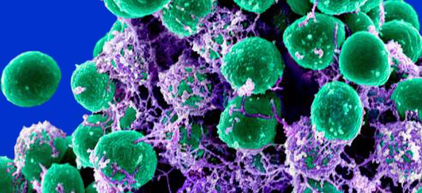 his 2011 digitally-colorized electron microscope image made available by the National Institute of Allergy and Infectious Diseases shows a clump of green-colored, spheroid-shaped, Staphylococcus epidermidis bacteria on a purple-colored matrix.