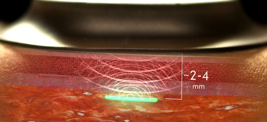 Here is Bill Gates’ Injectable Biochip, for Those Who Think it is Conspiracy Theory 860x394