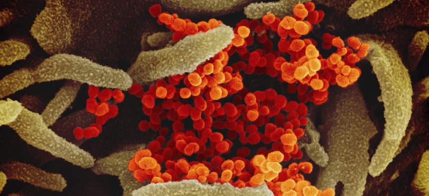 This undated electron microscope image made available by the U.S. National Institutes of Health in February 2020 shows the Novel Coronavirus SARS-CoV-2, orange, emerging from the surface of cells, green, cultured in the lab.